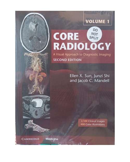 Core Radiology: A Visual Approach to Diagnostic Imaging (2 Vol Set) by Ellen X. Sun 2/e 2021