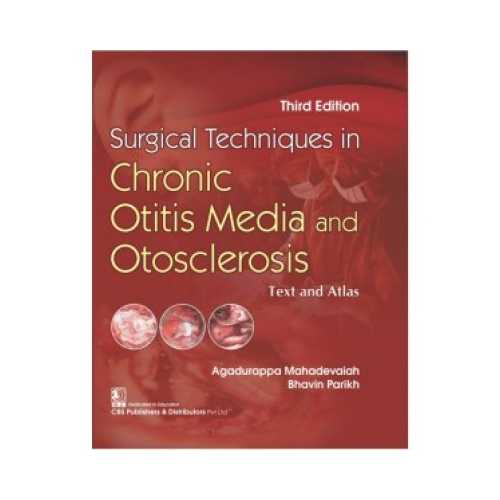 Surgical Techniques In Chronic Otitis Media and Otosclerosis By Agadurappa Mahadevaiah 3/e 2023