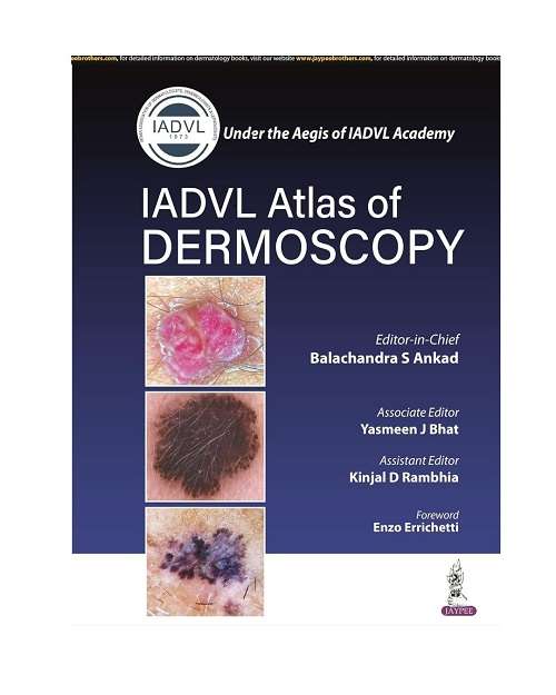 IADVL Atlas of Dermoscopy by Balachandra S Ankad 1/e 2022
