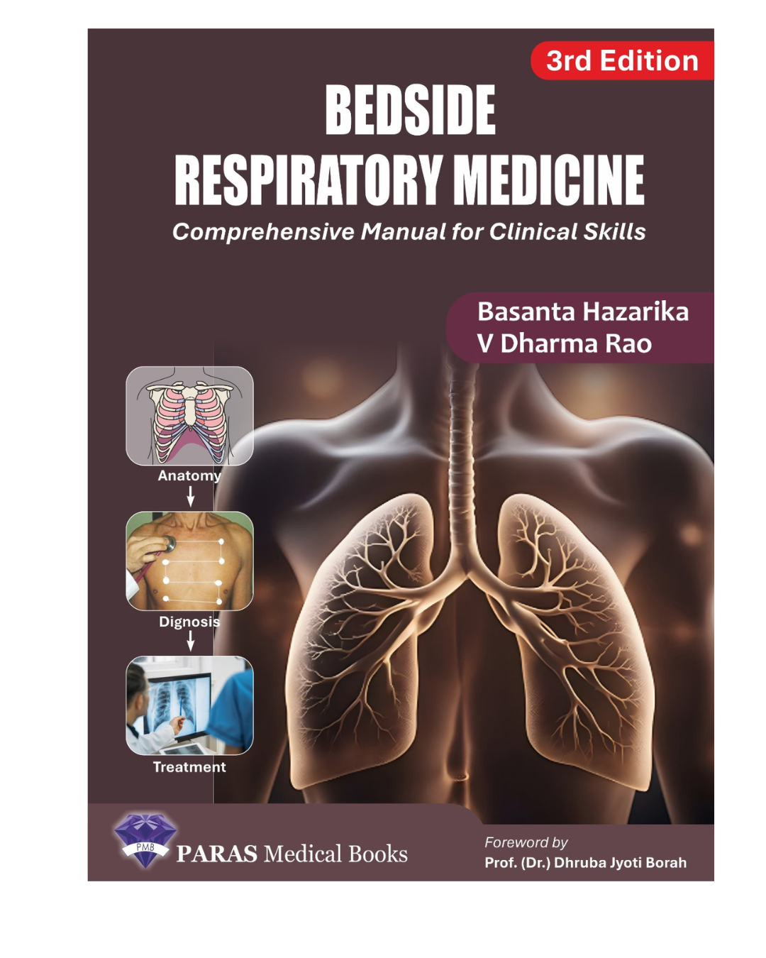 Bedside Respiratory Medicine 3/e 2025 by Basanta Hazarika