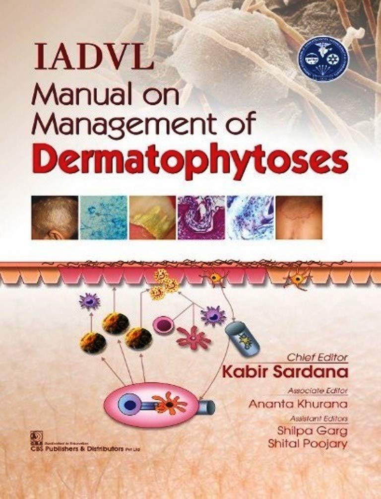 IADVL Manual on Management of Dermatophytoses 1/E 2018 by SARDANA K.