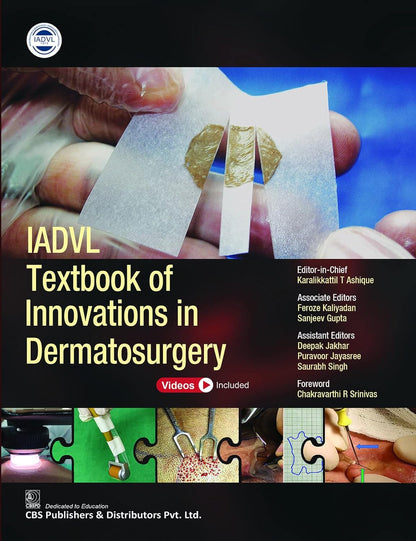 IADVL Textbook of Innovations in Dermatosurgery 1/E 2022 by Karalikkattil T Ashique
