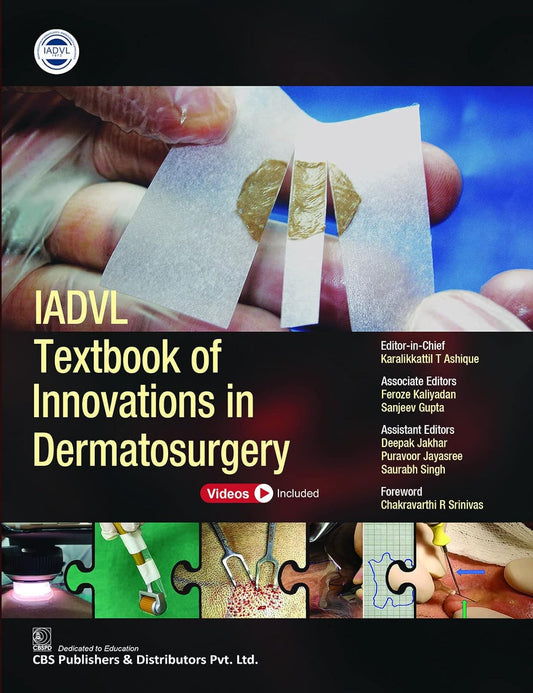 IADVL Textbook of Innovations in Dermatosurgery 1/E 2022 by Karalikkattil T Ashique