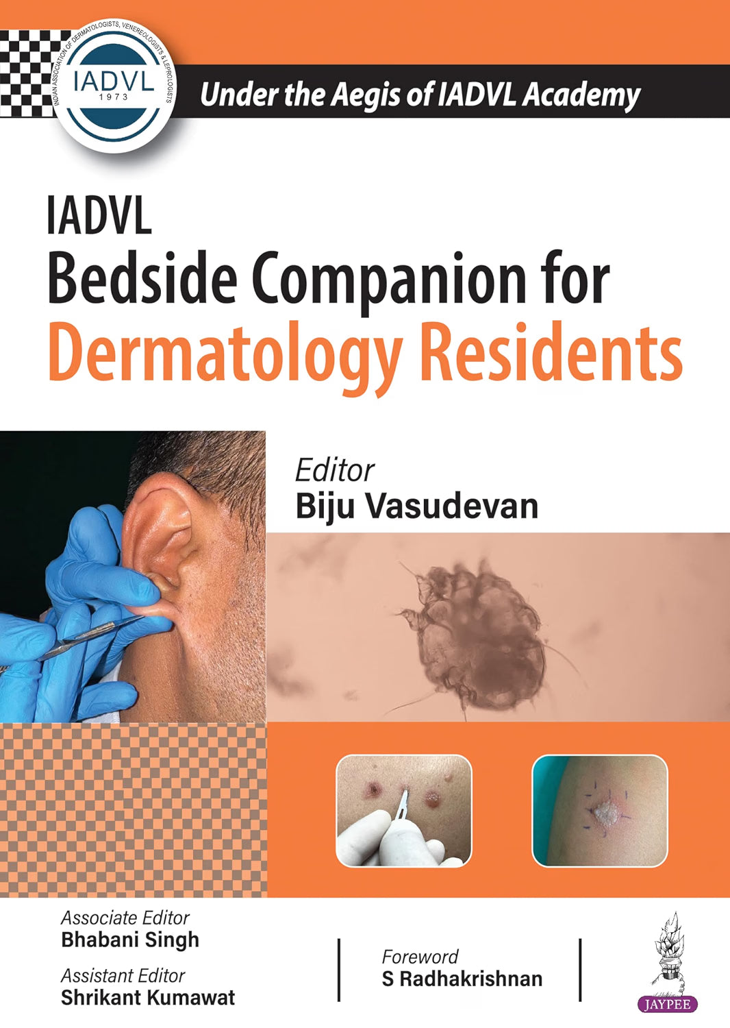IADVL Bedside Companion for Dermatology Residents by Biju Vasudevan