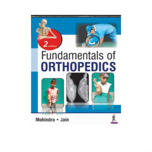 Fundamentals Of Orthopedics By Mukul Mohindra