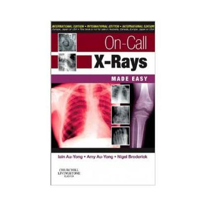 On Call X-Rays Made Easy 2010 By Iain Au-Yong