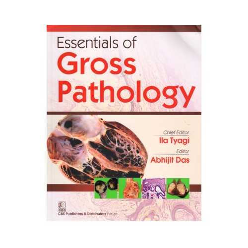 Essentials Of Gross Pathology by Ila Tyagi