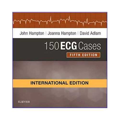 150 ECG Cases by John Hampton