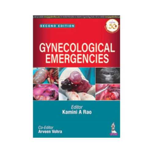 Gynecological Emergencies by Kamini A Rao