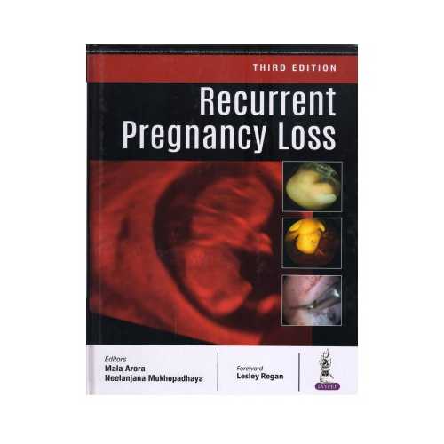 Recurrent Pregnancy Loss 3rd by Mala Arora