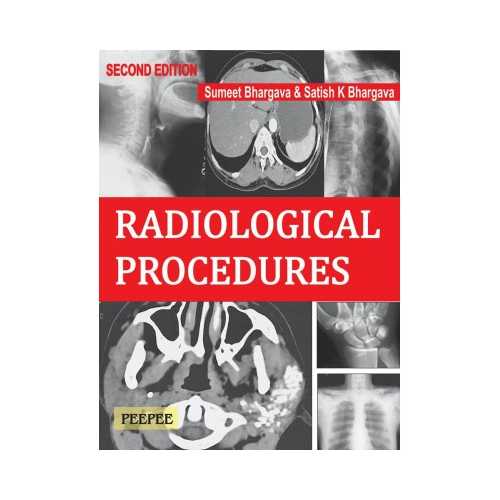 Radiological Procedures by Sumeet Bhargava