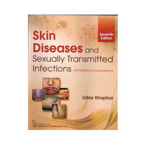 Skin Disease & Sexually Transmitted Infections 7th/2019 By Uday Khopkar