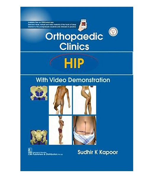 Orthopaedic Clinics: HIP: With Video Demonstration By Sudhir K Kapoor