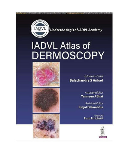 IADVL Atlas of Dermoscopy by Balachandra S Ankad 1/e 2022