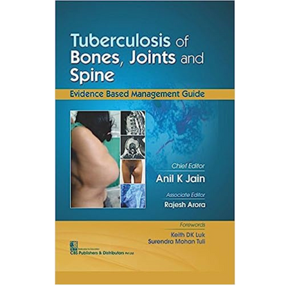 Tuberculosis of Bones Joints and Spine (HB 2017) By Anil K Jain