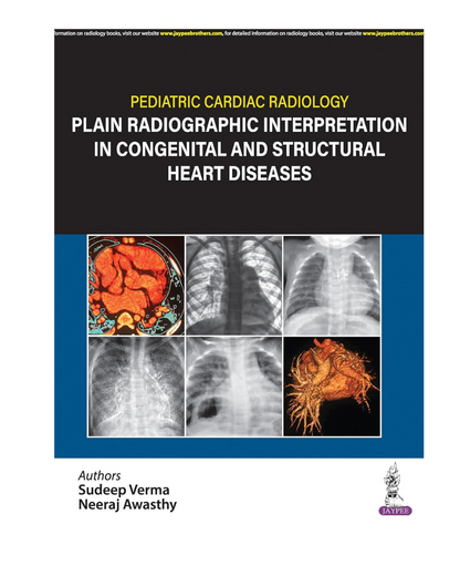 Pediatric Cardiac Radiology Plain Radiographic Interpretation in Congenital and Structural Heart Diseases 1/e 2024 by Sudeep Verma