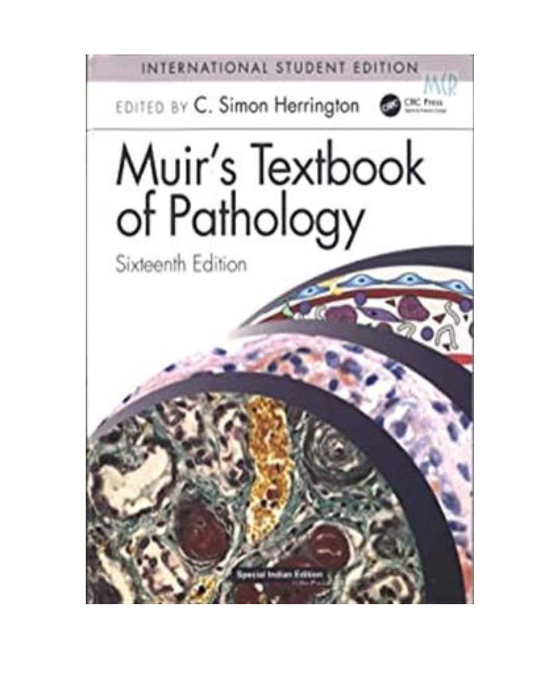 Muirs Textbook of Pathology Sixteenth Edition 2020 by Herrington C.S, Taylor & Francis