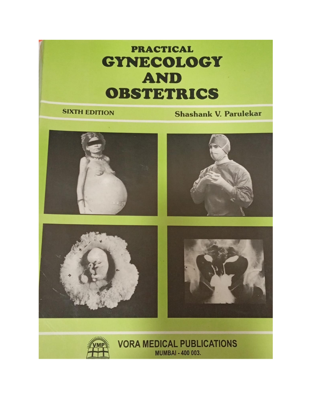 Practical Gynecology and Obstetrics 6/e 2020 By Shashank V. Parulekar