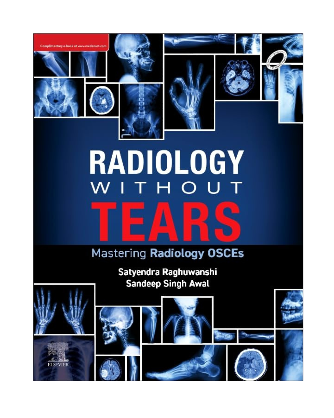 Radiology Without Tears: Mastering Radiology OSCEs 1/e 2025 by Satyendra Raghuwanshi