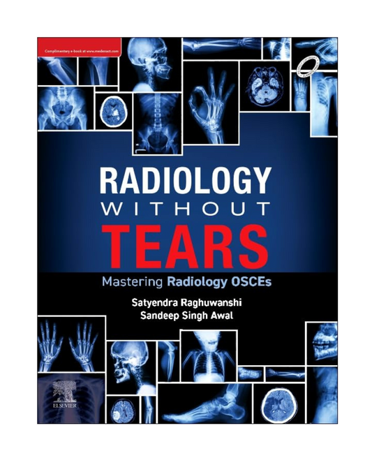 Radiology Without Tears: Mastering Radiology OSCEs 1/e 2025 by Satyendra Raghuwanshi