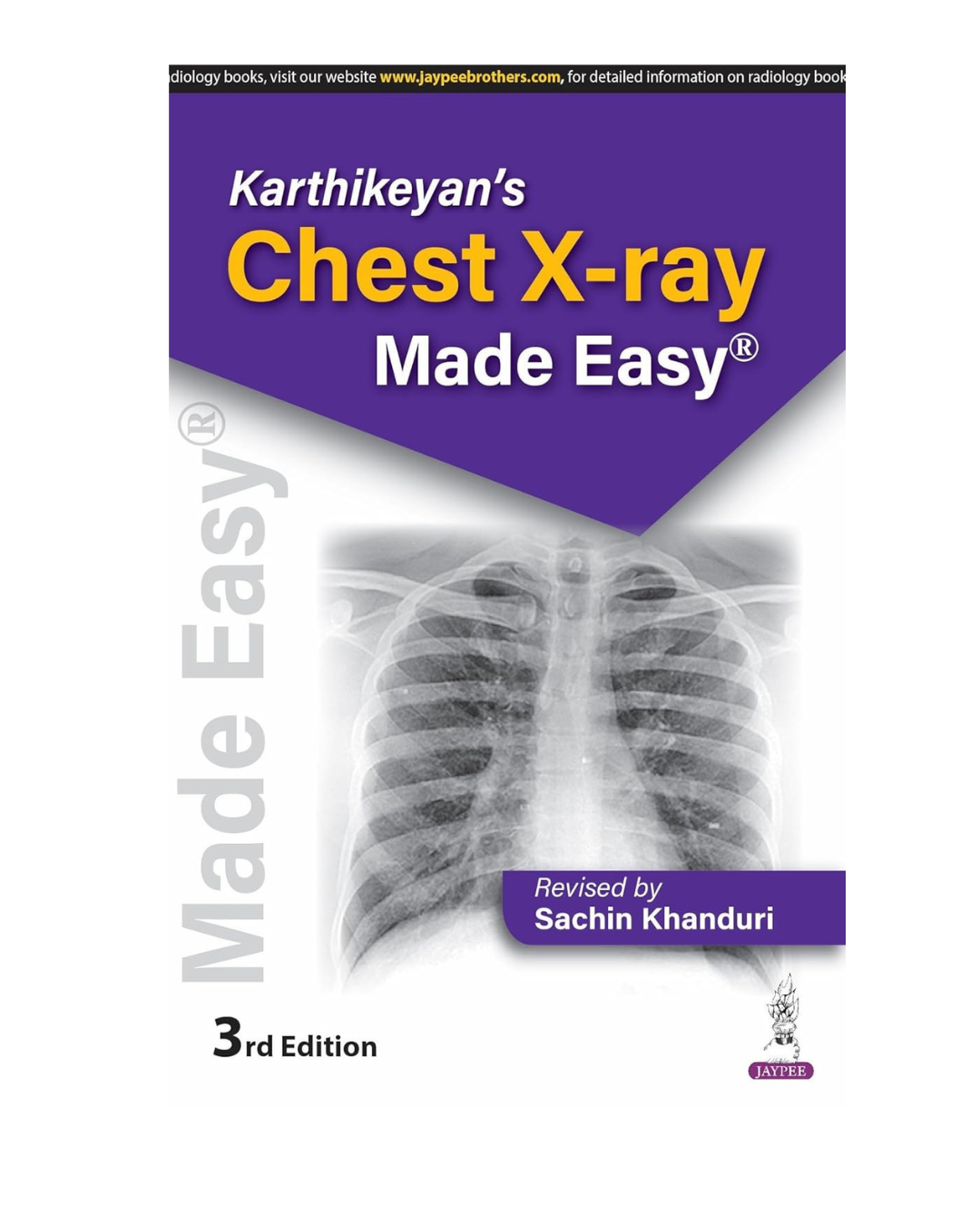 Karthikeyan's Chest X-Ray Made Easy 3/e 2025