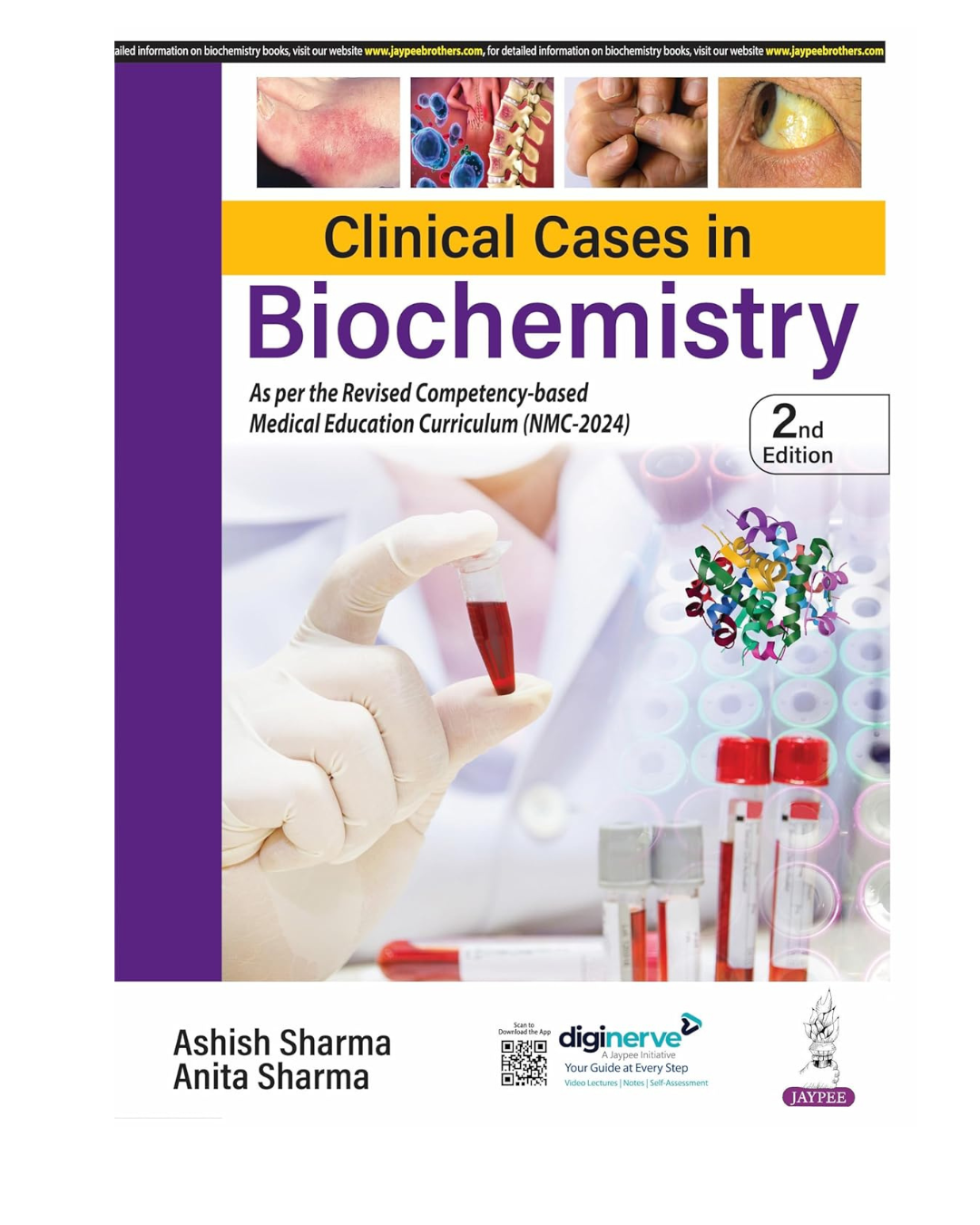 Clinical Cases in Biochemistry 2/e 2025 by Ashish Sharma