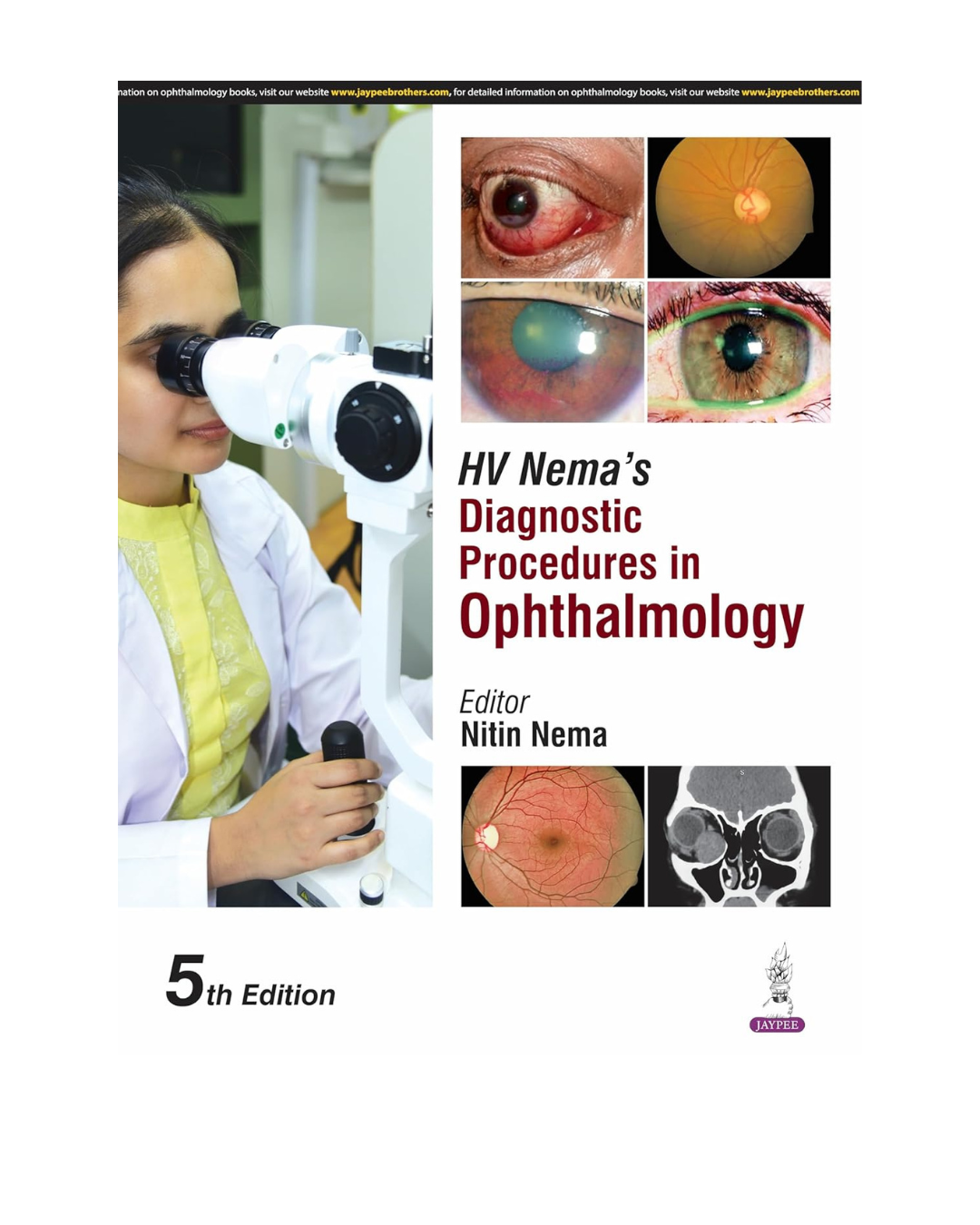 HV Nema's Diagnostic Procedures in Ophthalmology 5/e 2025 by Nitin Nema