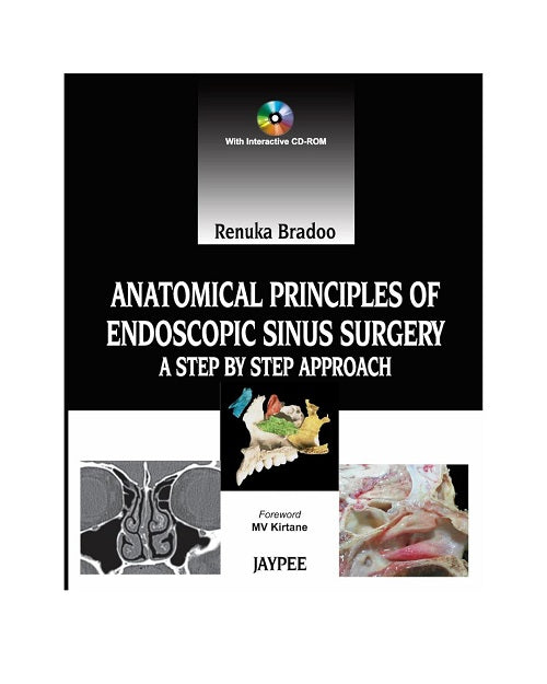 Anatomical Principles of Endoscopic Sinus Surgery: A Step by Step Approach by Renuka Bradoo