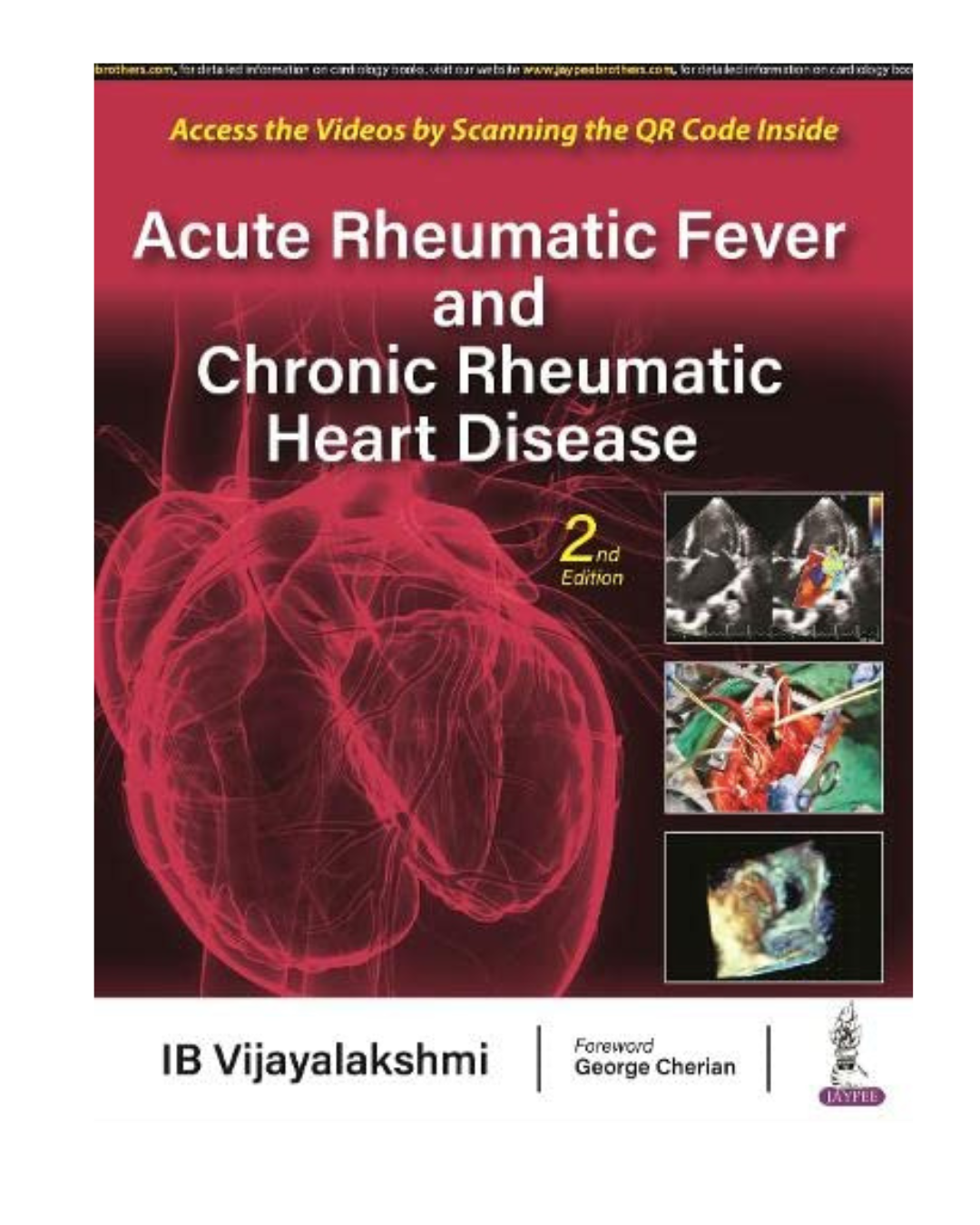 Acute Rheumatic Fever & Chronic Rheumatic Heart Disease 2/E 2023 -Rom By I.B. Vijayalakshmi