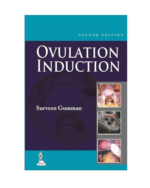 Step by Step Ovulation Induction with CD-ROM by Surveen Ghumman