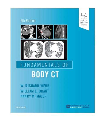 Fundamentals of Body CT by W Richard Webb 5/e 2020