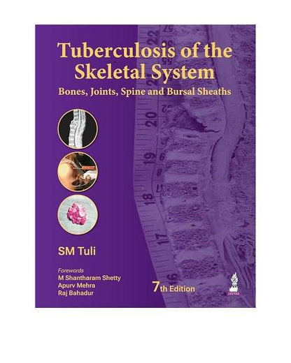 Tuberculosis of the Skeletal System (Bones, Joints, Spine and Bursal Sheaths) by SM Tuli 7/e 2026