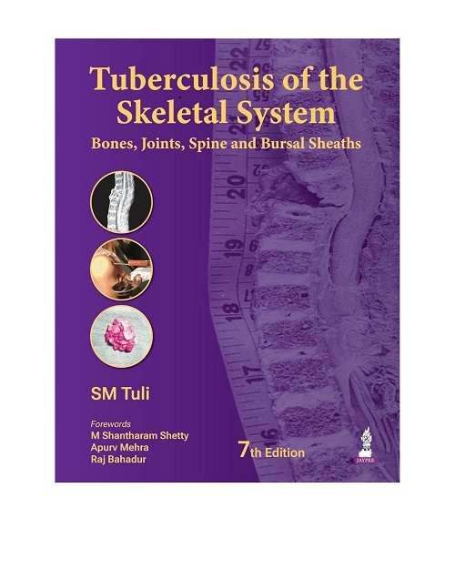 Tuberculosis of the Skeletal System (Bones, Joints, Spine and Bursal Sheaths) by SM Tuli 7/e 2026