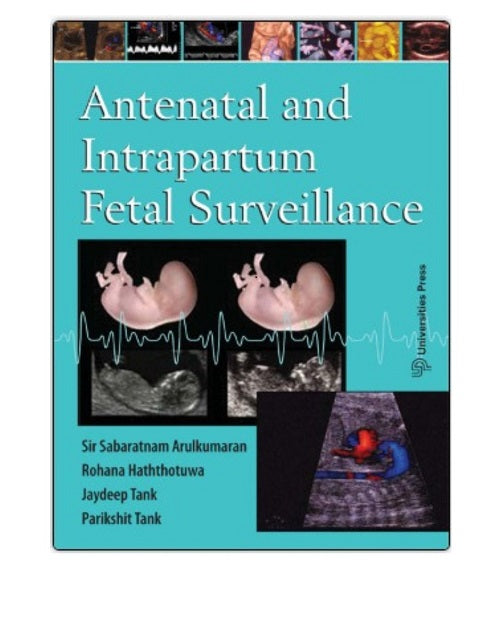 Antenatal and intrapartum Surveillance By Sir Sabaratnam Arulkumaran