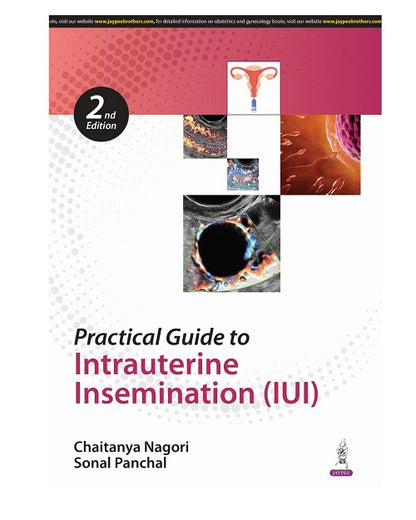 Practical Guide to Intrauterine Insemination (IUI) by Chaitanya Nagori 2/e 2025