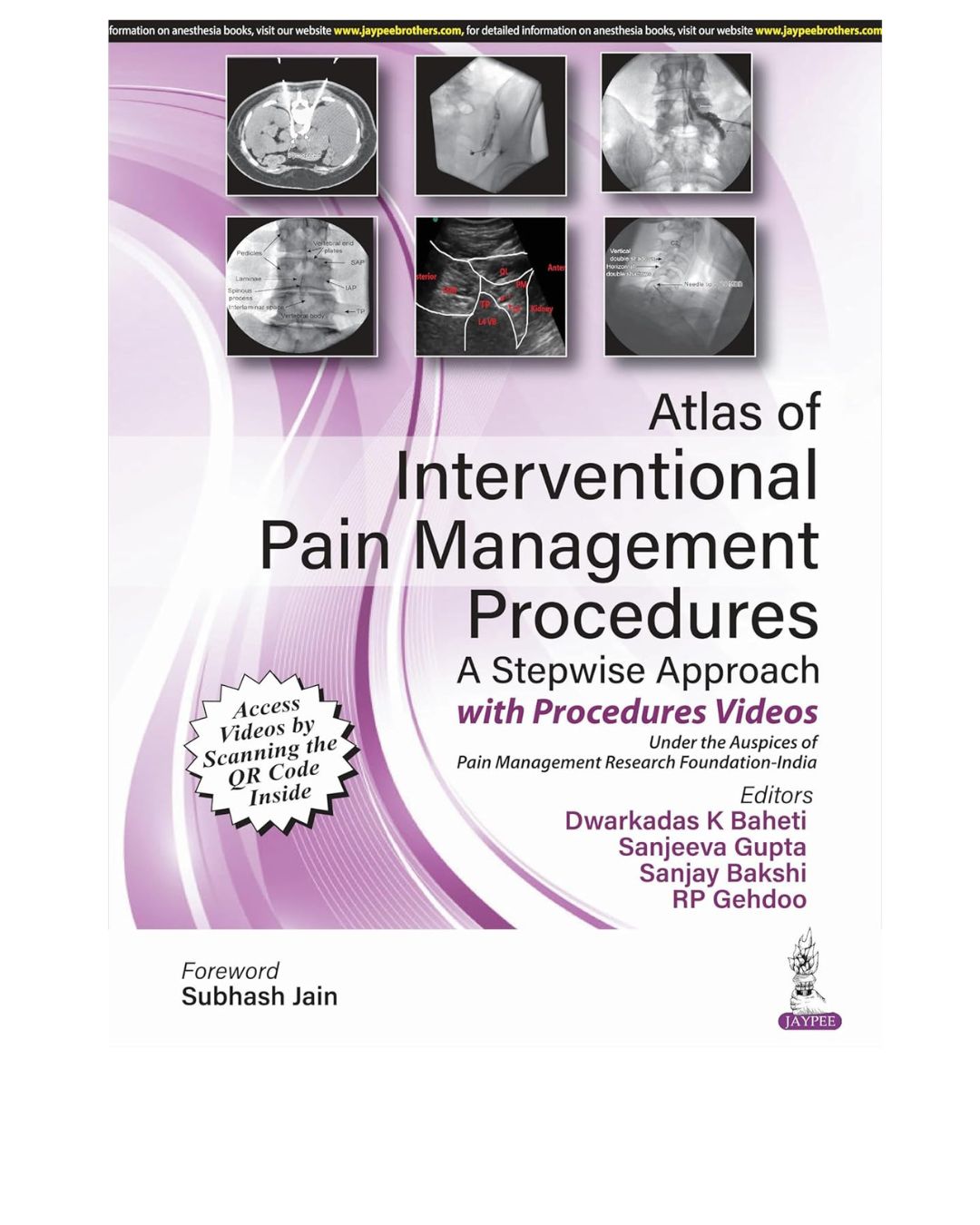 Atlas of Interventional Pain Management Procedures: A Stepwise Approach by Dwarkadas K Baheti 1/e 2026
