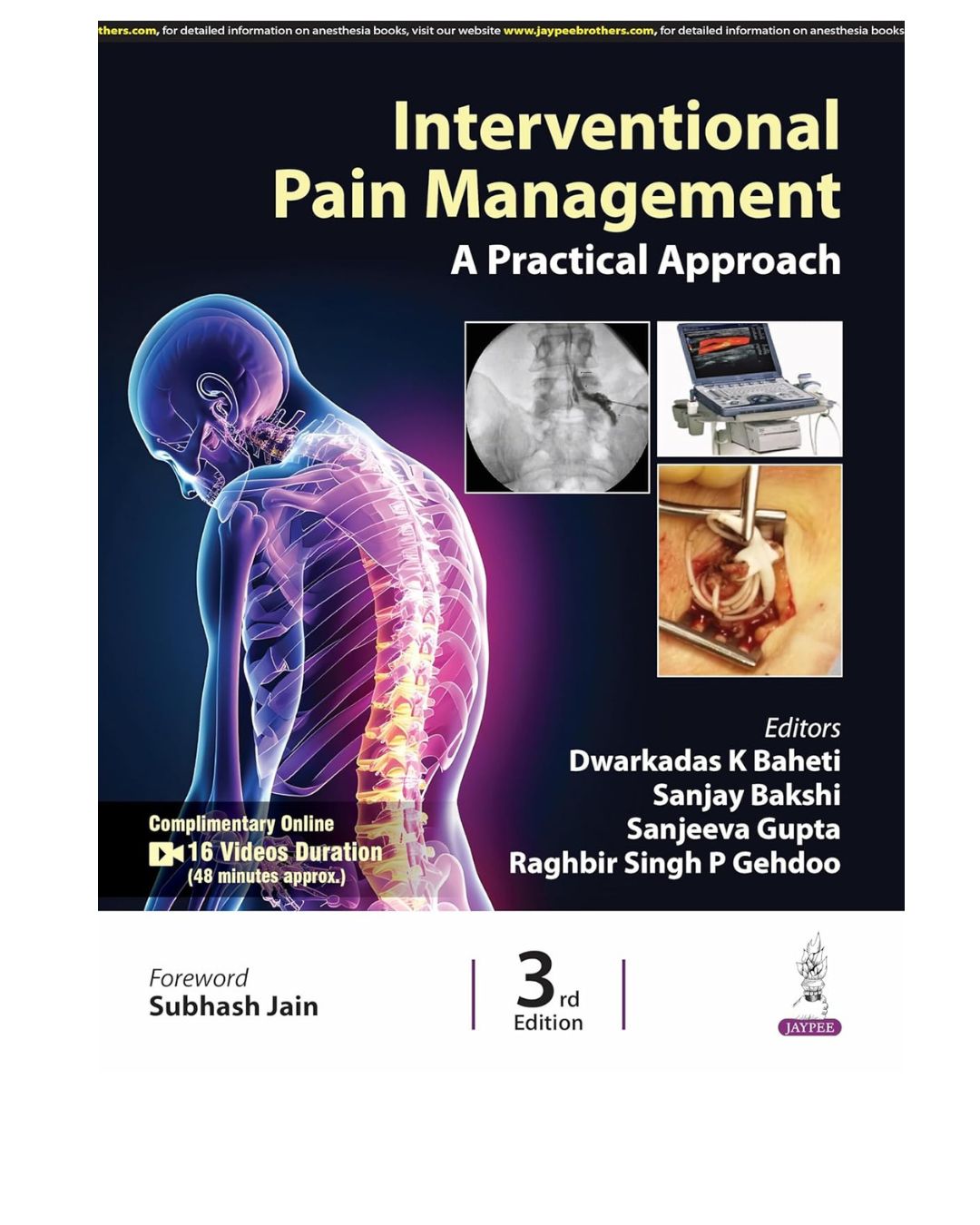 Interventional Pain Management a Practical Approach 3/e 2025 by Dwarkadas K Baheti