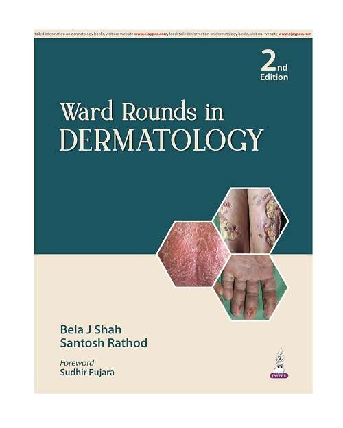Ward Rounds in Dermatology by Bela J Shah 2/e 2026