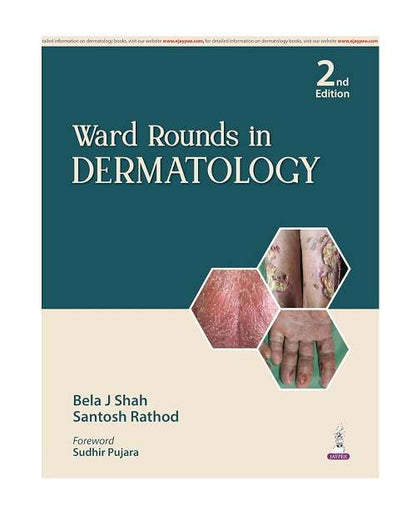 Ward Rounds in Dermatology by Bela J Shah 2/e 2026