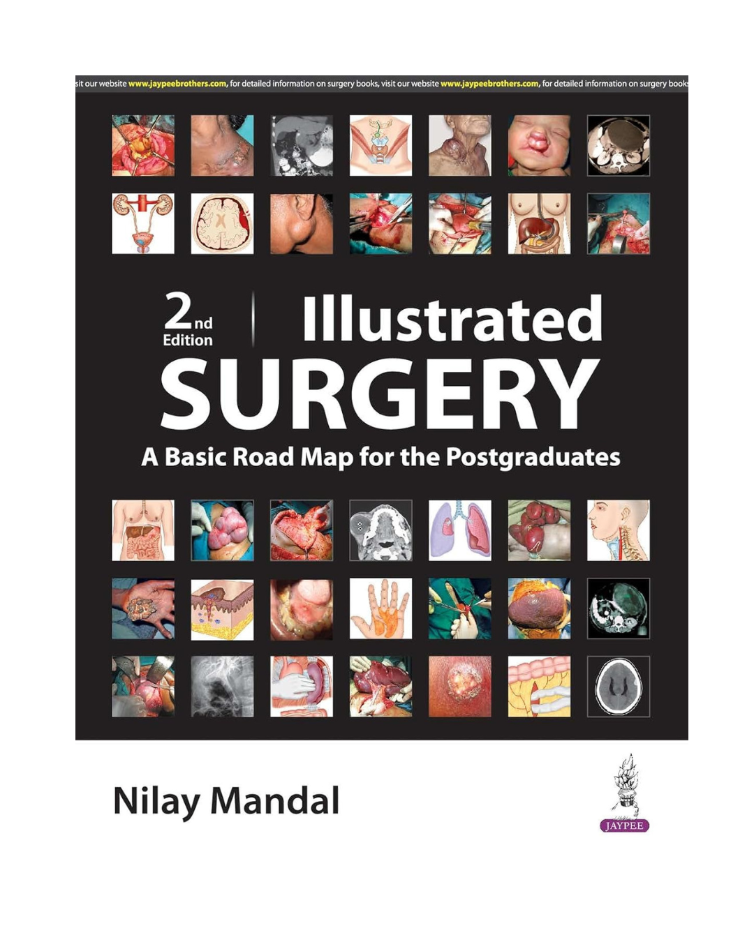Illustrated Surgery A Basic Road Map For The Postgraduates 2/e 2024 by Nilay Mandal