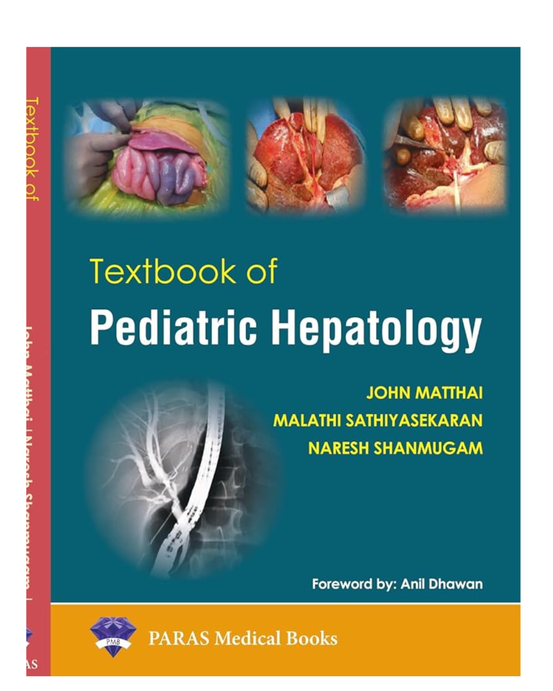 Textbook of Pediatric Hepatology 1/e 2023 by John Matthai