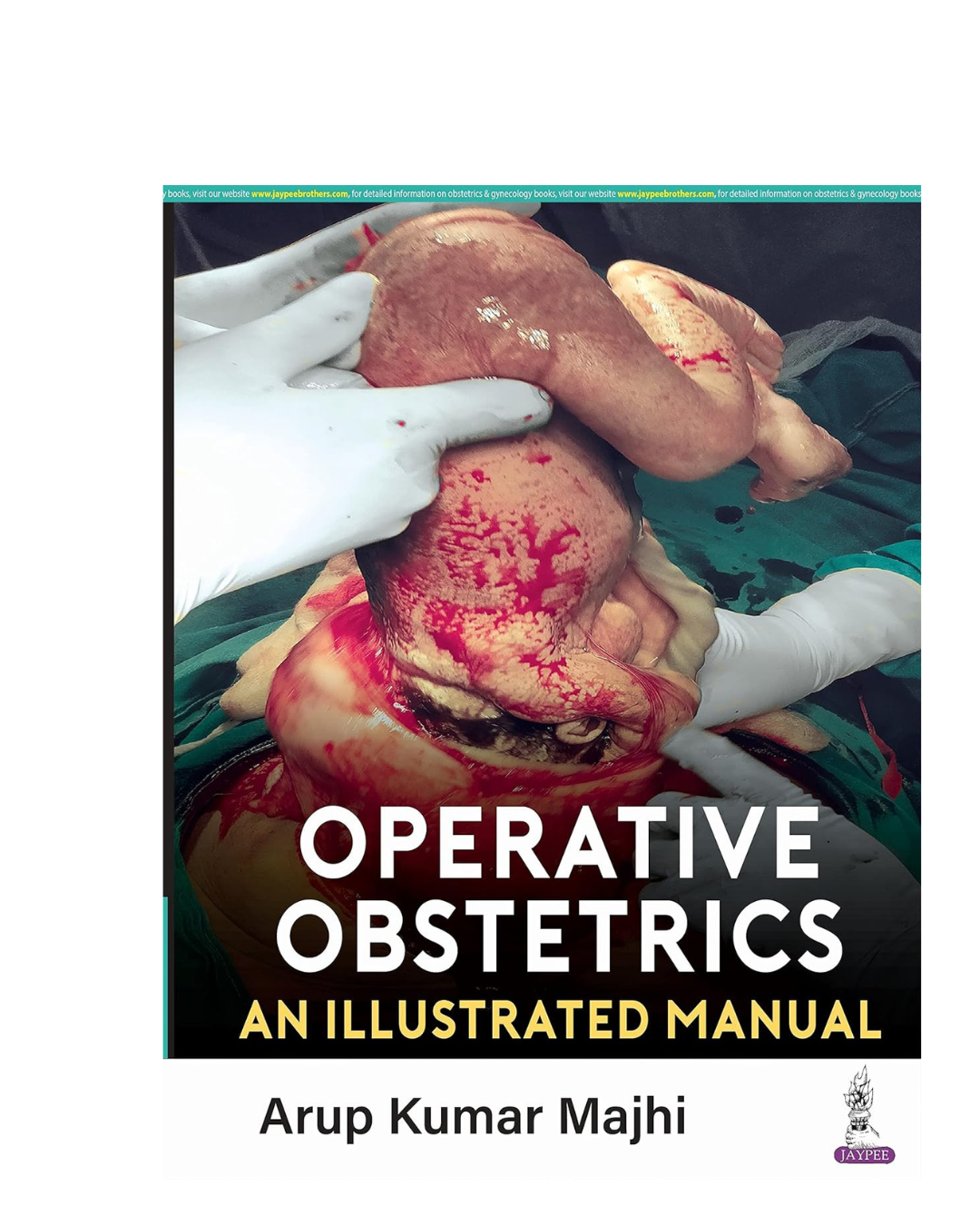 Operative Obstetrics: An Illustrated Manual 1/e 2023 by Arup Kumar Majhi