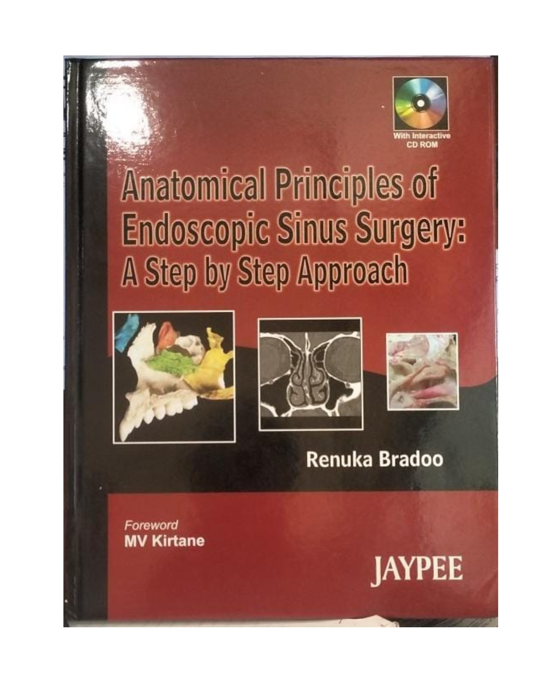 Anatomical Principles of Endoscopic Sinus Surgery: A Step by Step Approach by Renuka Bradoo