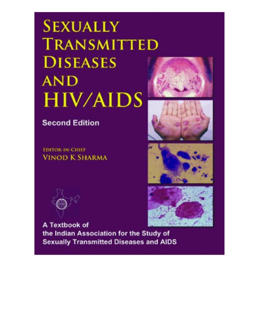 Sexually Transmitted Diseases And HIV/AIDS By Vinod K Sharma