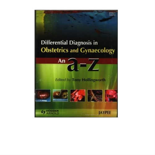 Differential Diagnosis In Obstetrics And Gynaecology An A-Z By Tony Hollingworth