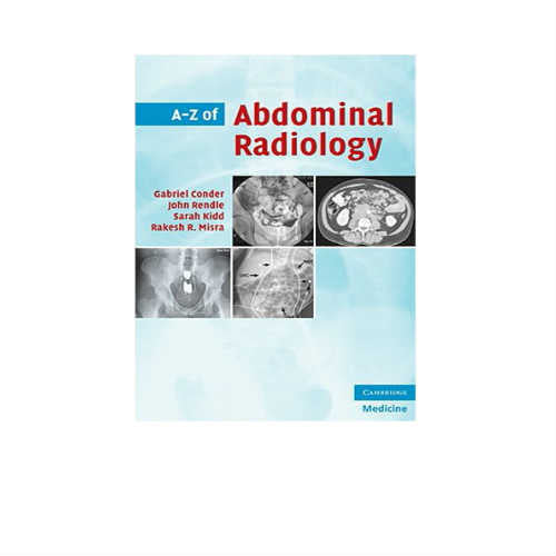 A-Z of Abdominal Radiology By Gabriel Conder