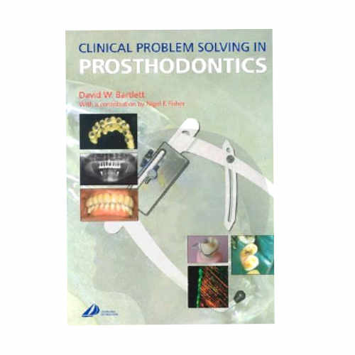 Clinical Problem Solving in Prosthodontics 1/e By David Bartlett