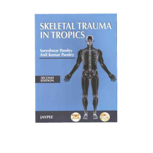 Skeletal Trauma In Tropics By Sureshwar Pandey
