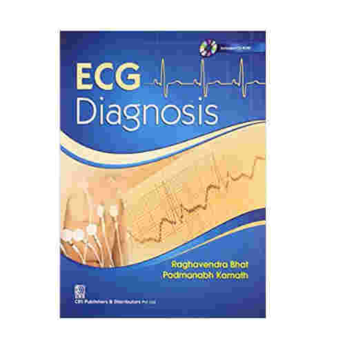ECG DIAGNOSIS By Raghavendra Bhat