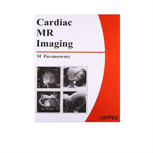 Cardiac MR Imaging By Puvaneswary